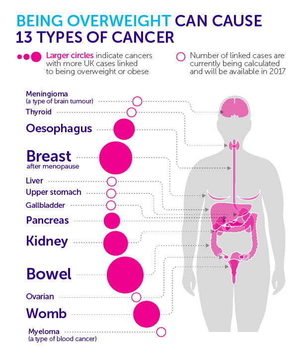 overweight-cancer